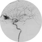 Angiography Services