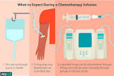 Cancer Chemotherapy