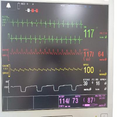Capnometer & ETCO2 Monitor