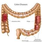 Colorectal Surgery