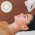 Cosmetic Acupuncture Services