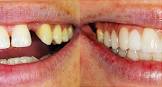 Cosmetic Dental Procedures