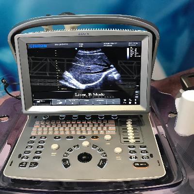 Echocardiogram Machine