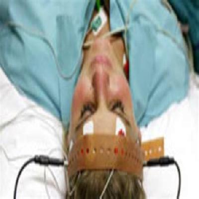 Electroconvulsive Therapy
