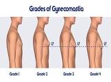 Gynecomastia Surgery