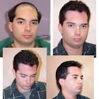 Hair Bonding Services