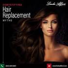 Hair Replacement Services