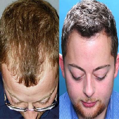 Hair Fixing 