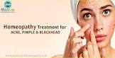 Homeopathy Skin Treatment Service