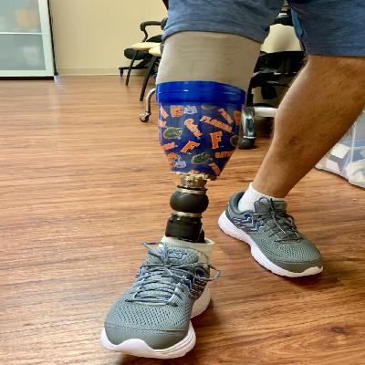 Knee Prosthesis 