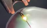 Laser Welder
