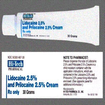 Lidocaine Prilocaine Cream