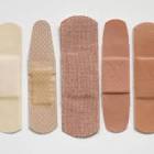 Medical Adhesives