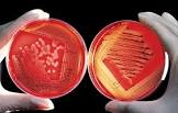 Microbial Culture