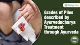 Piles Ayurvedic Treatment