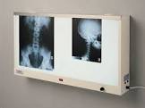 Radiographic Film Viewer