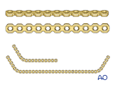 Reconstruction Plates