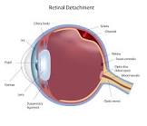 Retina Treatment Services