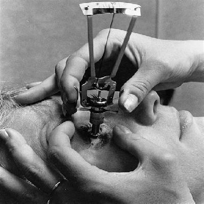 Schiotz Tonometer