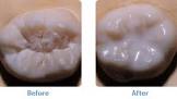 Sealants