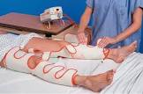 Sequential Compression Device
