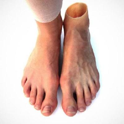 Silicone Foot Prosthesis