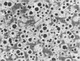 Spheroidal Graphite Iron