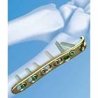 Titanium Bone Plates