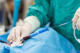 Vascular Surgery