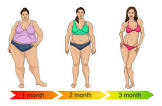 Weight Loss Surgery