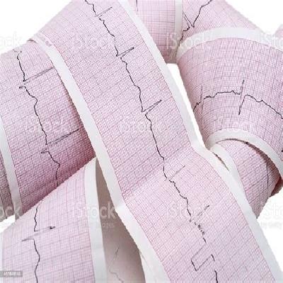 ECG PAPER