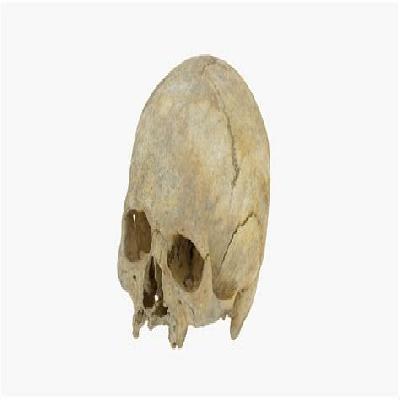 Leprosy Model 