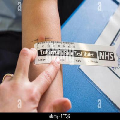 Mentoux Test Forensic Models