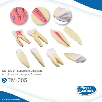 Expansion Model Of Human Teeth