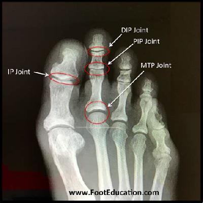 Foot Joint Imported