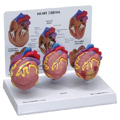 Heart Model Imported
