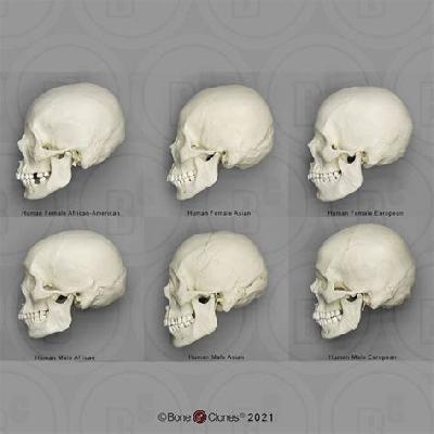 Human Skull Imported