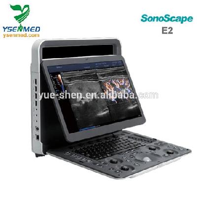 SonoScape E2 Portable Colour Doppler System