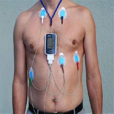 ECG Holter