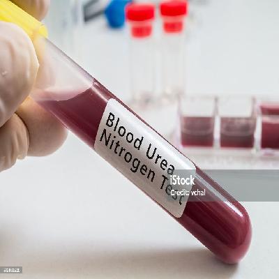 Accurex Liquid Autozyme Urea Laboratory Reagent