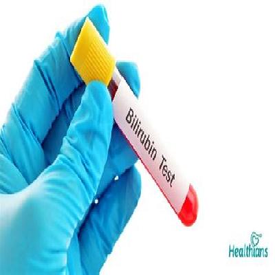 Bilirubin Test Kit