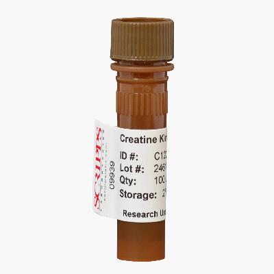 Creatine Kinase MB (CK-MB) Antibody