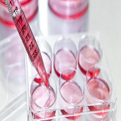 Animal Cell Culture Media