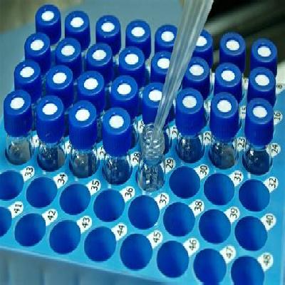 HPLC Column Selection