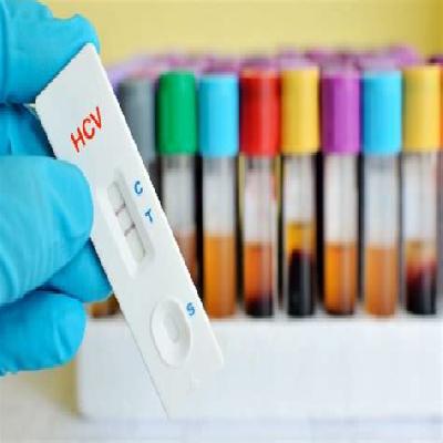HCV Avecon