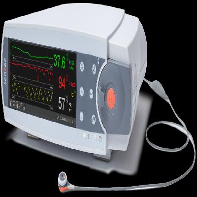 Ventilator Monitor