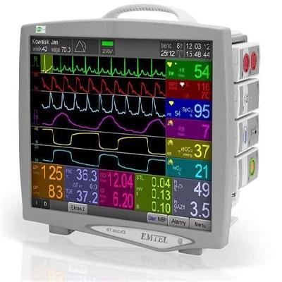 Exchange Parameter Monitor