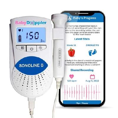 Fetal Doppler
