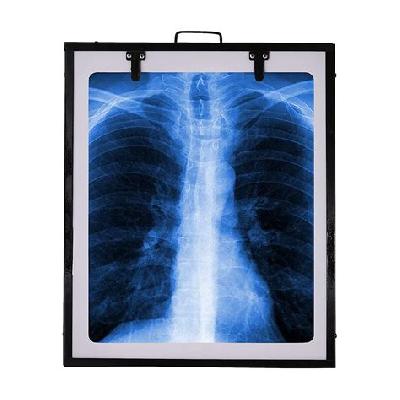 X Ray View Box