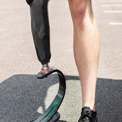 Carbon Fibre Pipe and Rods for Prosthesis